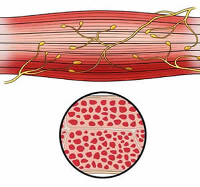 Muscle After EMSculpt Treatment
