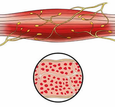 Muscle Before EMSCulpt Treatment